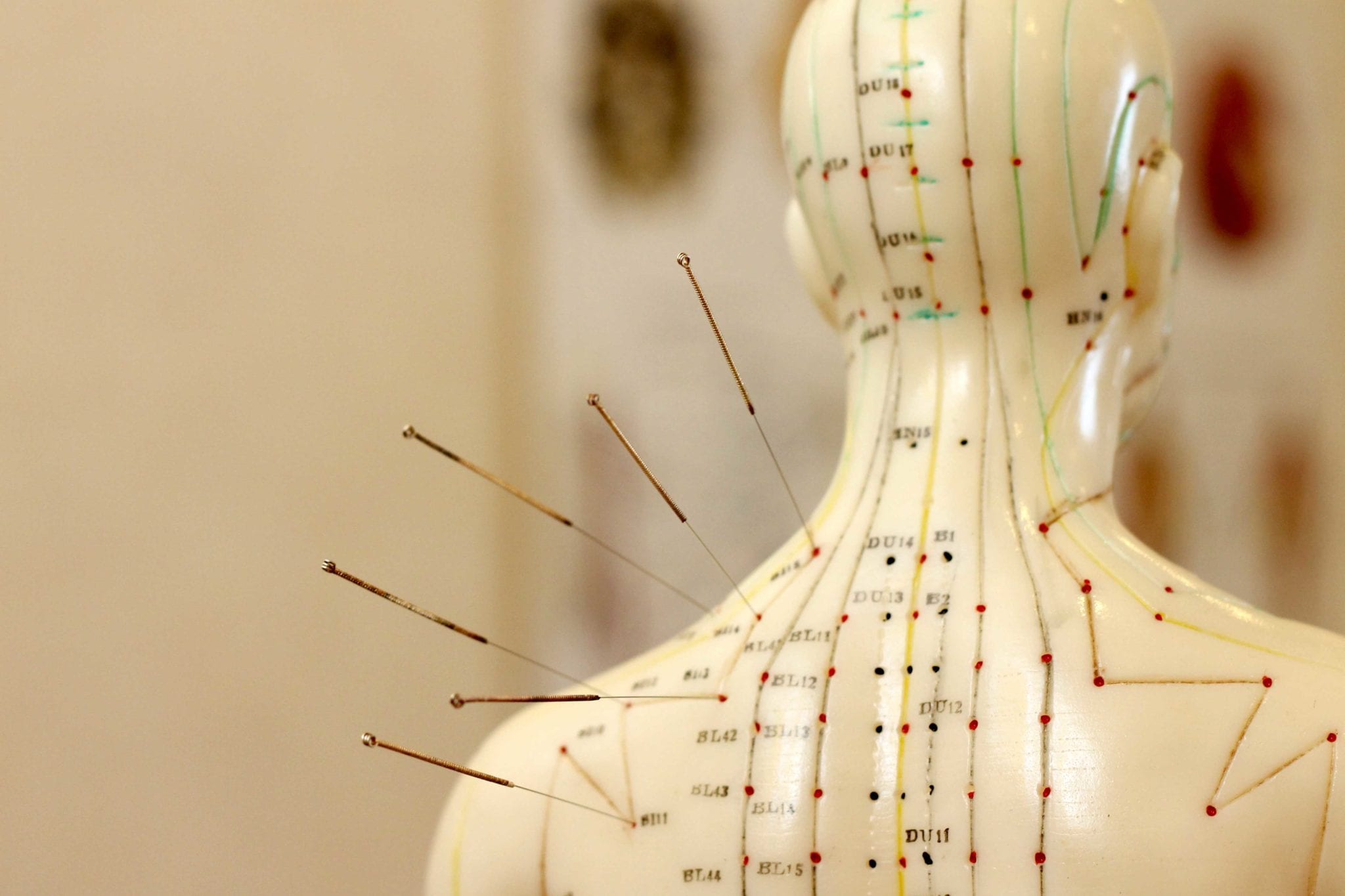 Acupuncture Medicare Rebate