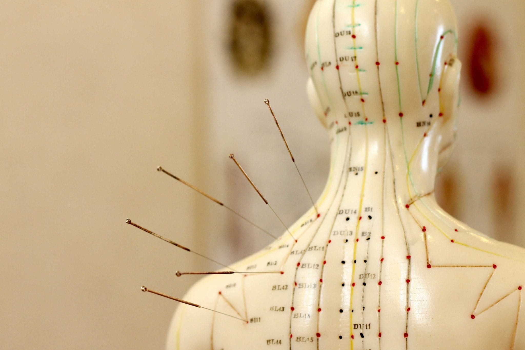 Acupuncture Jos SAUVAIRE Praticien